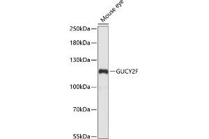 Western blot analysis of extracts of mouse eye, using GUCY2F antibody (ABIN7267553) at 1:1000 dilution. (GUCY2F 抗体  (AA 250-460))