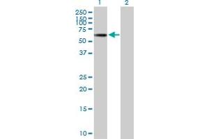 Western Blot analysis of TINAGL1 expression in transfected 293T cell line by TINAGL1 MaxPab polyclonal antibody. (TINAGL1 抗体  (AA 1-467))