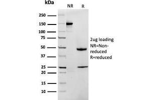 SDS-PAGE Analysis Purified MTAP Recombinant Mouse Monoclonal Antibody (rMTAP/1813). (Recombinant MTAP 抗体  (AA 97-196))