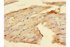 Immunohistochemistry of paraffin-embedded human skeletal muscle tissue using ABIN7167280 at dilution of 1:100 (RAB28 抗体  (AA 98-218))