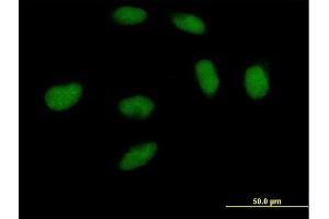 Immunofluorescence of purified MaxPab antibody to DNMT3A on HeLa cell. (DNMT3A 抗体  (AA 1-912))