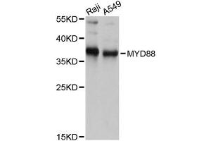 Western blot analysis of extracts of various cell lines, using MYD88 antibody (ABIN6290608) at 1:1000 dilution. (MYD88 抗体)