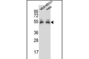 PRCP Antibody (N-term) (ABIN657308 and ABIN2846386) western blot analysis in MDA-M,Hela cell line lysates (35 μg/lane). (PRCP 抗体  (N-Term))
