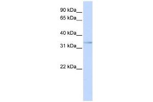 ETV3L antibody used at 0. (ETV3L 抗体  (C-Term))