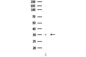 Western blot analysis of lysates from EC304 cells, using OR8G5 Antibody at 1/1000 dilution.