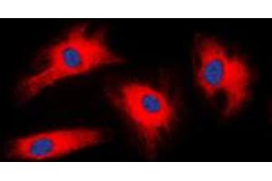 Immunofluorescent analysis of 14-3-3 zeta staining in HeLa cells. (14-3-3 zeta 抗体  (Center))