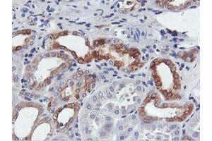 Image no. 10 for anti-Farnesyl-Diphosphate Farnesyltransferase 1 (FDFT1) antibody (ABIN1498243)