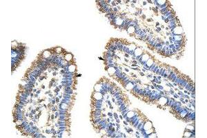 Image no. 1 for anti-Frizzled Family Receptor 9 (FZD9) (AA 181-230) antibody (ABIN202792) (FZD9 抗体  (AA 181-230))