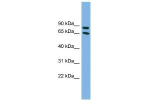 WB Suggested Anti-DAB1 Antibody Titration: 0. (DAB1 抗体  (Middle Region))