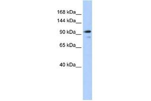 WB Suggested Anti-AMOTL1 Antibody Titration:  0. (AMOTL1 抗体  (N-Term))