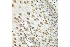 Immunohistochemistry (Paraffin-embedded Sections) (IHC (p)) image for anti-Non-POU Domain Containing, Octamer-Binding (NONO) (AA 1-300) antibody (ABIN6144713)