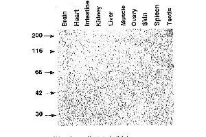 Western Blotting (WB) image for anti-SLA (Haploid Sperm Cell-Specific Antigen) antibody (ABIN3201019) (SLA (Haploid Sperm Cell-Specific Antigen) 抗体)