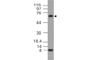Image no. 1 for anti-Tumor Protein P73 (TP73) antibody (ABIN5027775) (Tumor Protein p73 抗体)