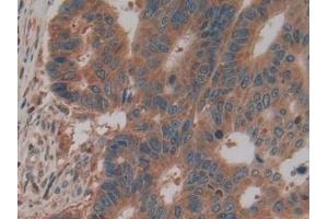 Immunohistochemistry (IHC) image for anti-Pyruvate Kinase M2 (PKM2) (AA 141-248) antibody (ABIN7432133)