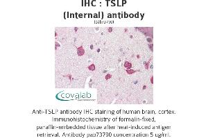 Image no. 1 for anti-Thymic Stromal Lymphopoietin (TSLP) (Internal Region) antibody (ABIN1740422) (Thymic Stromal Lymphopoietin 抗体  (Internal Region))