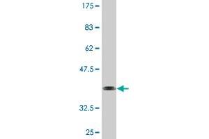 Western Blot detection against Immunogen (36. (HSFY1 抗体  (AA 1-99))
