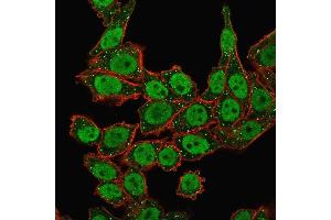 Immunofluorescence Analysis of human HeLa cells labeling APEX Nuclease I with APEX Nuclease I Mouse Monoclonal Antibody (CPTC-APEX1-2) followed by Goat anti-Mouse IgG-CF488 (Green).