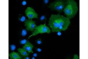 Image no. 2 for anti-DnaJ (Hsp40) Homolog, Subfamily A, Member 2 (DNAJA2) antibody (ABIN1497859) (DNAJA2 抗体)