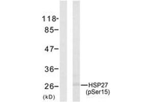 Western blot analysis of extracts from HeLa cells treated with UV, using HSP27 (Phospho-Ser15) Antibody. (HSP27 抗体  (pSer15))