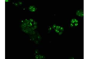 Immunofluorescence staining of PC-3 cells with ABIN7144653 at 1:166, counter-stained with DAPI. (ARNTL 抗体  (AA 366-585))