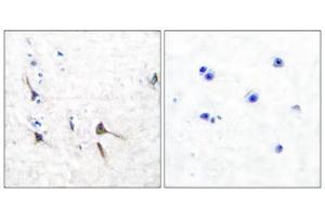 Immunohistochemical analysis of paraffin-embedded human brain tissue using Potassium Channel Kv3. (Kv3.2b Potassium Channel 抗体  (C-Term))