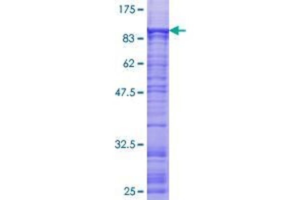 ZNF449 Protein (AA 1-518) (GST tag)