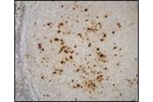Immunohistochemistry (IHC) image for anti-Epstein-Barr Virus (EBV) (Internal Region) antibody (ABIN870464) (EBV 抗体  (Internal Region))