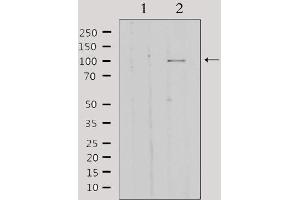 Western Blotting (WB) image for anti-General Transcription Factor IIIC, Polypeptide 2, beta 110kDa (GTF3C2) (N-Term) antibody (ABIN6257244)
