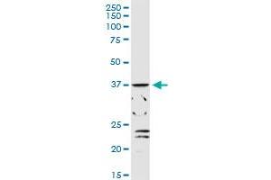 ADH1C MaxPab rabbit polyclonal antibody. (ADH1C 抗体  (AA 1-375))