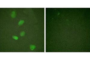 TNF-a - +Immunofluorescence analysis of HeLa cells, treated with TNF-a (20nM, 15mins), using HDAC3 (Ab-424) antibody. (HDAC3 抗体)