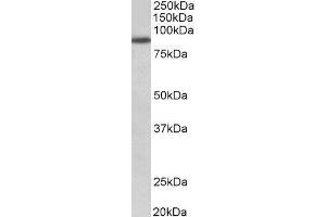ABIN2562591 (1µg/ml) staining of A549 lysate (35µg protein in RIPA buffer). (FGFR1 抗体  (Internal Region))