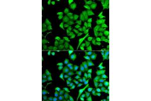 Immunofluorescence analysis of A549 cells using NAA50 antibody. (NAA50 抗体  (AA 1-169))