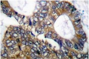 Image no. 1 for anti-Heat Shock 105kDa/110kDa Protein 1 (HSPH1) antibody (ABIN265469) (HSPH1 抗体)