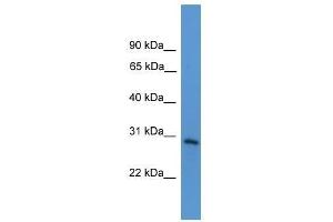 TNFRSF4 antibody used at 0. (TNFRSF4 抗体  (Middle Region))
