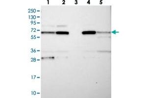 Western blot analysis of Lane 1: RT-4, Lane 2: U-251 MG, Lane 3: Human Plasma, Lane 4: Liver, Lane 5: Tonsil with CPEB4 polyclonal antibody  at 1:250-1:500 dilution. (CPEB4 抗体)