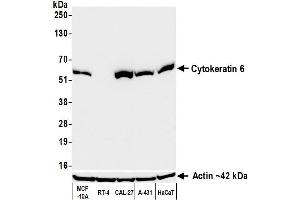 Western Blotting (WB) image for anti-Keratin 6 (KRT6) (C-Term) antibody (ABIN7795793) (Recombinant Keratin 6 抗体  (C-Term))
