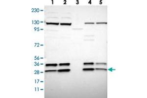 Western blot analysis of Lane 1: RT-4, Lane 2: U-251 MG, Lane 3: Human Plasma, Lane 4: Liver, Lane 5: Tonsil with SSR3 polyclonal antibody . (SSR3 抗体)