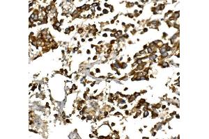 IHC analysis of IGF1 using anti-IGF1 antibody (ABIN7601895). (IGF1 抗体  (AA 50-118))