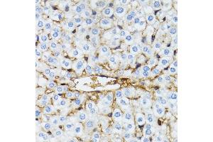 Immunohistochemistry of paraffin-embedded mouse liver using SERPING1 antibody (ABIN6290125) at dilution of 1:100 (40x lens). (SERPING1 抗体)