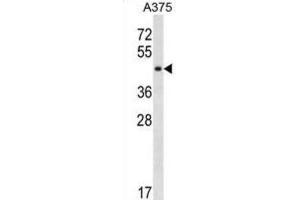 Western Blotting (WB) image for anti-SGT1, Suppressor of G2 Allele of SKP1 (SUGT1) antibody (ABIN3000456) (SUGT1 抗体)