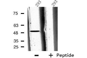 Western blot analysis of extracts from 293 cells, using CPA5 antibody. (CPA5 抗体  (Internal Region))