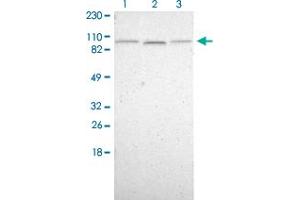 Western Blot (Cell lysate) analysis of (1) Human cell line RT-4, (2) Human cell line U-251MG sp and (3) Human cell line A-431. (KIAA0323 抗体)