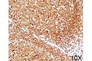 IHC testing of human tonsil (10X) stained with CD79a antibody (JCB117). (CD79a 抗体  (AA 202-216))