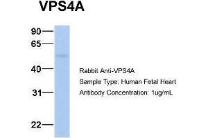 Host: Rabbit Target Name: VPS4A Sample Type: Human Fetal Heart Antibody Dilution: 1. (VPS4A 抗体  (N-Term))