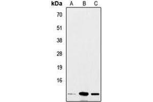 Western blot analysis of Insulin expression in A549 (A), mouse heart (B), rat liver (C) whole cell lysates. (Insulin 抗体  (Center))