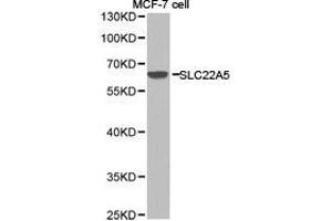 Western Blotting (WB) image for anti-Solute Carrier Family 22 Member 5 (SLC22A5) antibody (ABIN1874815) (SLC22A5 抗体)