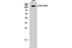Western Blotting (WB) image for anti-PTK2 Protein tyrosine Kinase 2 (PTK2) (pTyr407) antibody (ABIN3182535) (FAK 抗体  (pTyr407))