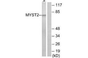 Western blot analysis of extracts from Jurkat cells, using MYST2 antibody. (MYST2 抗体  (Internal Region))