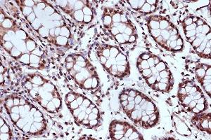 Immunohistochemistry of paraffin-embedded human colon using MSH2 Rabbit mAb (ABIN7268547) at dilution of 1:100 (40x lens). (MSH2 抗体)