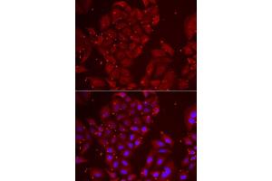 Immunofluorescence analysis of U2OS cells using TPP2 antibody. (Tpp2 抗体  (AA 1-300))